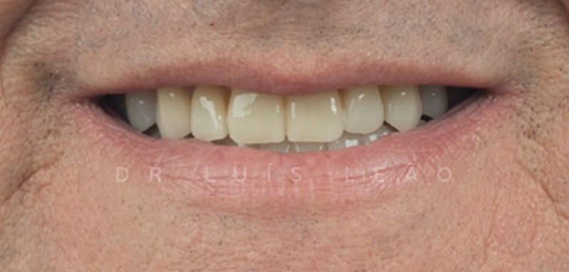 ortodontia caso 5